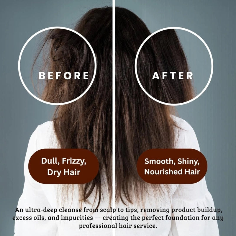 Aurey Clarifying Pro Shampoo With Aloe Vera &amp; D-Panthenol 5000 ml