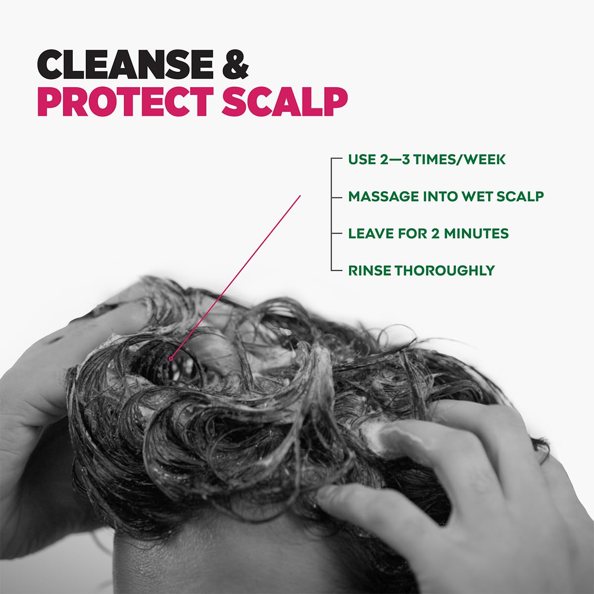 Sebamed Anti Dandruff Shampoo (200ml)